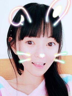 太原美莱全脸脂肪填充+自体脂肪丰胸恢复果图