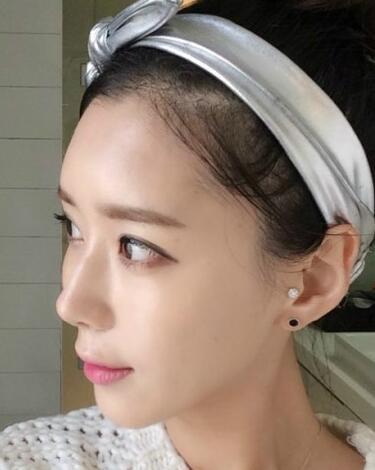 果酸嫩肤多少钱？我做成890元，果图分享给大家