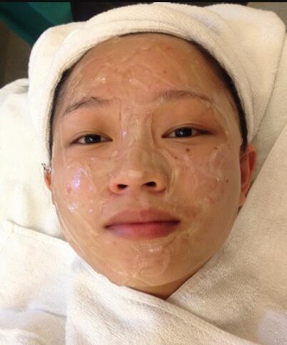 有人做过光子嫩肤吗？自己做过，感觉果不错分享