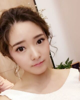 全切微创双眼皮恢复图，长沙希美蒋松林手术案例