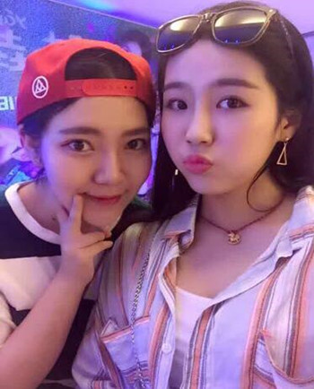 武汉美亚金国华医生帮我做的自体脂肪全脸填充果恢复案例