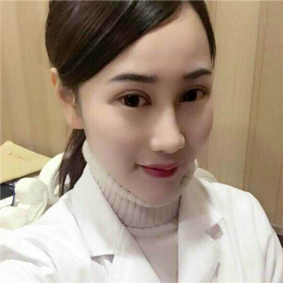 绵阳朗睿赵波做的切开双眼皮，分享恢复过程和前后对比果图片~