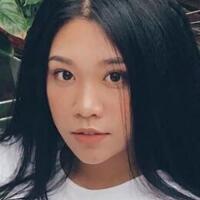 玻尿酸去法令纹前后对比图分享