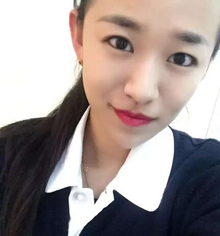 注射瘦脸去抬头纹眉间纹恢复过程图，真实案例分享