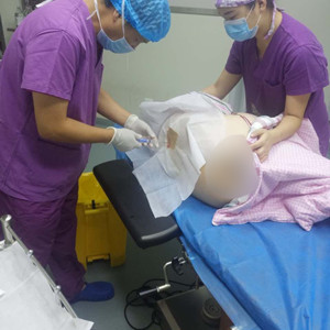 青海康华冯相周医生大腿抽脂案例分享