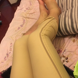 青海康华冯相周医生大腿抽脂案例分享