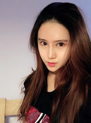 成都美未央隆鼻整形手术恢复日记图