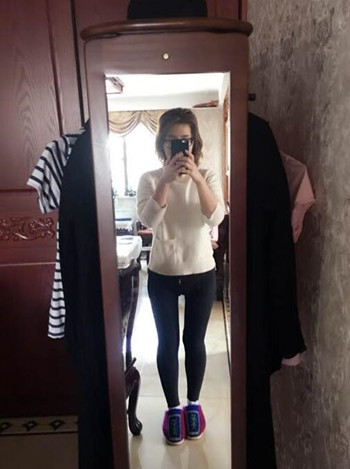 广州美莱罗延平做的大腿环吸整形恢复果过程案例