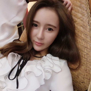 济南海峡赵广生做的自体耳软骨垫鼻尖+硅胶隆鼻前后对比照片分享