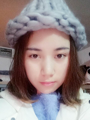 济南海峡谢燕燕做的切开双眼皮，分享前后对比照片以及恢复过程