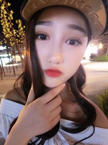 成都蜀尚蓉雅割双眼皮+开眼角真实案例