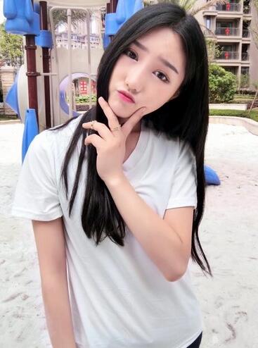 成都蜀尚蓉雅割双眼皮+开眼角真实案例