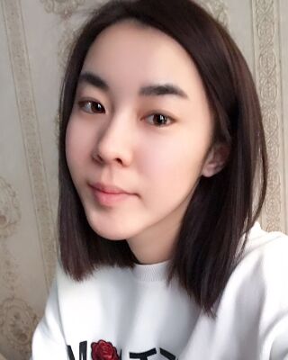 自体脂肪面部填充三个月果图分享，减龄十岁