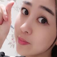 鼻翼缩小手术对比图分享——四川悦好整形