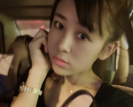 鼻翼缩小手术对比图分享——四川悦好整形