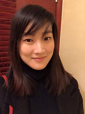 济南爱容路传燕医生做的激光去黄褐斑，大家快来看看果如何