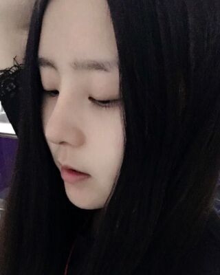 洛阳维多利亚隆鼻整形前后对比果图