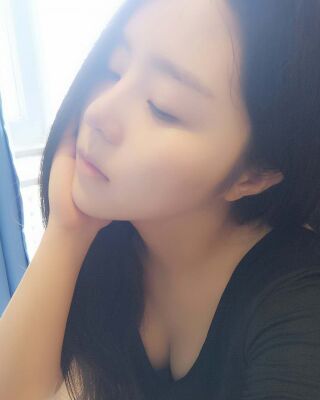 洛阳维多利亚隆鼻整形前后对比果图