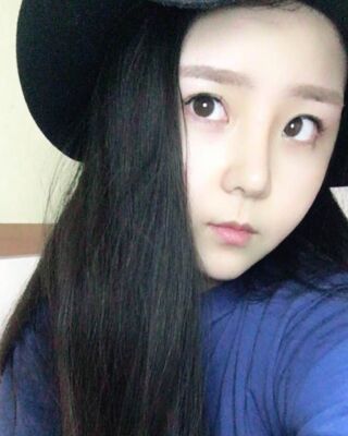 洛阳维多利亚隆鼻整形前后对比果图