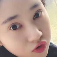 开眼角+割双眼皮真实案例前后对比图分享——四川悦好整形