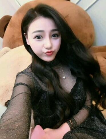 上海九院李圣利隆鼻整形真实恢复期图片