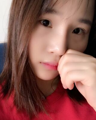 仇侃敏韩式隆鼻整形恢复果对比照片