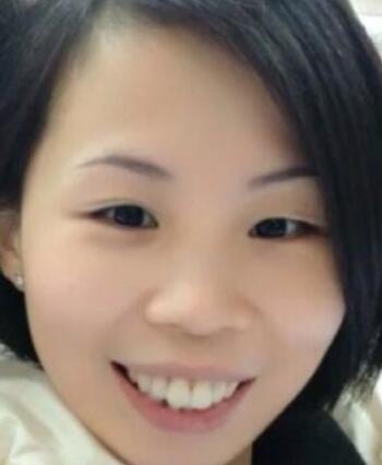 牙齿矫正的很好的年龄，多对比图真实案例分享——成都格林口腔