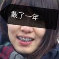 成都牙齿矫正前后对比图分享——成都格林口腔