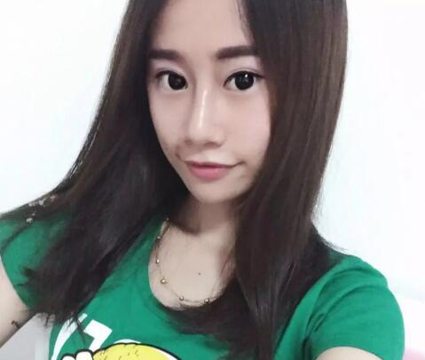 假体隆鼻恢复后果图