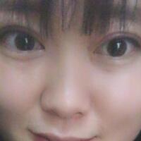 割双眼皮前后对比图和恢复过程——成都魅丽经纬整形医院