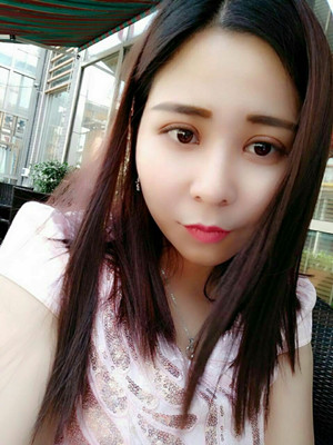 深圳南西子袁新平医生做的割双眼皮+开眼角前后恢复过程图片分享