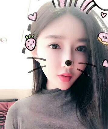 武汉西婵康美假体隆鼻+眼部综合整形