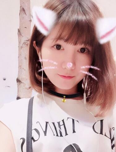 杭州王圣林全切双眼皮恢复过程图