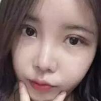 单眼皮变双眼皮整容日记——厦门安黛美整形医院