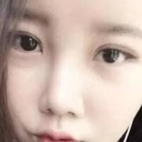 单眼皮变双眼皮整容日记——厦门安黛美整形医院