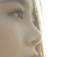 隆鼻整形价格和真实恢复期图片——杭州悦可整容医院