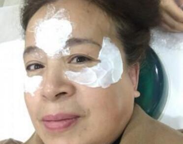 去抬头纹很好的方法？注射瘦脸去抬头纹鱼尾纹