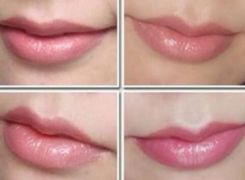 丰唇降低风险吗?果好不好?多少钱?