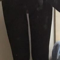 光纤溶脂瘦大腿有的方法真实案例分享——西安瑞丽整形