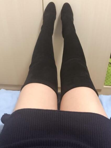 吸脂减肥瘦大腿前后对比图，光纤溶脂瘦大腿较有的方法真实案例