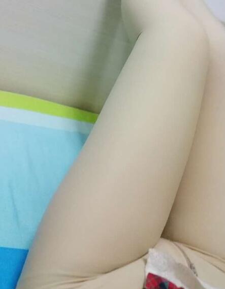 吸脂减肥瘦大腿前后对比图，光纤溶脂瘦大腿较有的方法真实案例