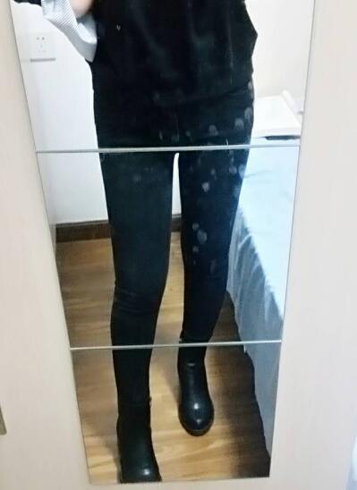 吸脂减肥瘦大腿前后对比图，光纤溶脂瘦大腿较有的方法真实案例