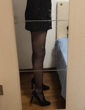 吸脂减肥瘦大腿前后对比图，光纤溶脂瘦大腿较有的方法真实案例