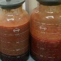 水动力吸脂瘦大腿真实案例多对比图经历——西安瑞丽整形