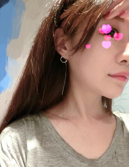 北京磨下颌角整形的果图