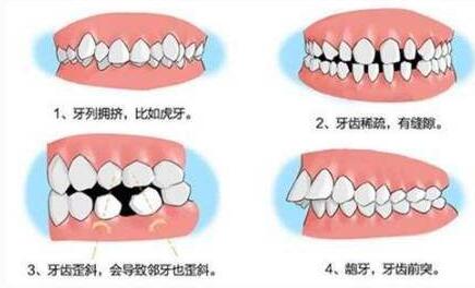 牙齿矫正
