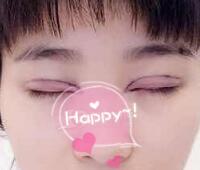 时光整形医院做的割双眼皮手术价格5200元 双眼皮对比图恢复过程