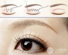 割双眼皮老了以后会有后遗症吗？