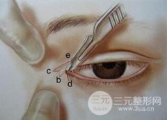 开完眼角多久可以化妆?