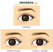 韩式开眼角有什么优势？
